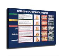 BIRXPMOS Professional, Gum Disease Progression Chart illustrating 4 Stages, Educational Canvas Wall-Art for Clinic, Classroom Study Room Decor(Framed,12x18inch(30x45cm))