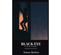 Black Eye: For everyone who thought it would always stay this way