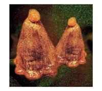 Black To Comm - Oocyte Oil & Stolen Androg (Vinyl Green)