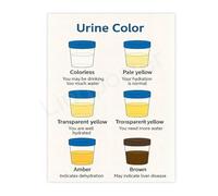 Body Hydration Status Chart Educational Canvas Print for Bathroom Office Wellness Clinic Decor(Unframed,16x24inch(40x60cm))