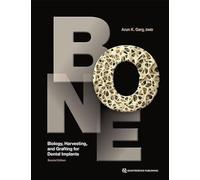 Bone: Biology, Harvesting, and Grafting for Dental Implants
