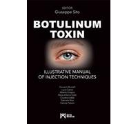 Botulinum toxin. Ilustrative manual of injection techniques. Ediz. a colori