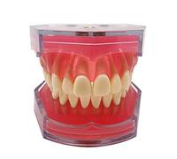 BOVDC Modello Dentale Modello Denti Esercitazione per Dimostrazione Gengive Morbide Disassemblaggio Completo Esercizi Estrazione Denti per Dentista Comunicare Pazient