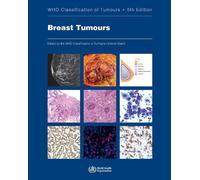 Breast Tumours - Who Classification of Tumours Editorial Board - 2019