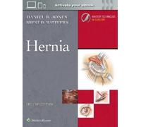 Brent D. Matthe Master Techniques in Surgery: Hernia: Print + (Copertina rigida)