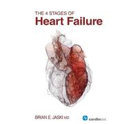Brian E. Jaski The 4 Stages of Heart Failure (Tascabile)
