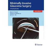 Brian Francis Steven Sarkisian Jam Minimally Invasive Glaucom (Copertina rigida)