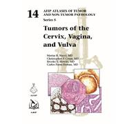 Brooke E. Howitt Christopher P. Crum Car Tumors of the Cervi (Copertina rigida)