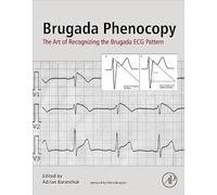 Brugada Phenocopy: The Art of Recognizing the Brugada ECG Pattern