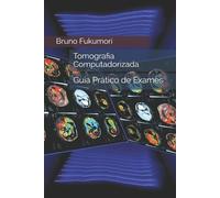 Bruno Fukumori Tomografia Computadorizada (Tascabile)