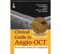 Bruno Lumbroso Yali Jia Dav Clinical Guide to Angio-OCT: Non (Copertina rigida)