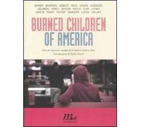 Burned children of America