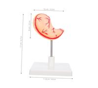 Cabilock Modello Stomaco Dettagliato Per Insegnamento Anatomia Supporto Scientifico Per Studio e Dimostrazione