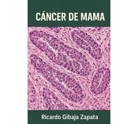 CANCER DE MAMA