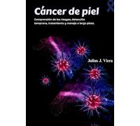 Cáncer de piel: Comprensión de los riesgos, detección temprana, tratamiento y manejo a largo plazo.
