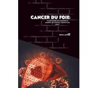 Cancer du foie: Un guide complet pour comprendre ses symptômes, son traitement, sa gestion et plus encore !