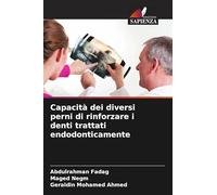 Capacità dei diversi perni di rinforzare i denti trattati endodonticamente