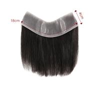 Capelli frontale da uomo con anello a V che copre l'attaccatura dei capelli...