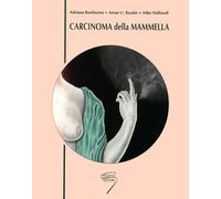 Carcinoma della mammella