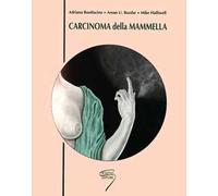 Carcinoma della mammella