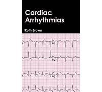 Cardiac Arrhythmias (Copertina rigida)