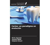 Caries: un paradigma en evolución