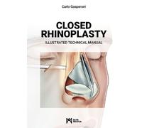 Carlo Gasperoni Closed Rhinoplasty (Copertina rigida)