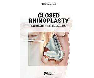 Carlo Gasperoni Closed Rhinoplasty (Copertina rigida)