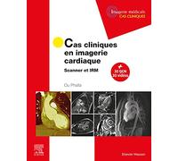 Cas cliniques en imagerie cardiaque: Scanner et IRM