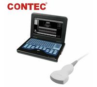 CE Nuova macchina portatile portatile ecografo digitale sonda 3.5MHz Convex