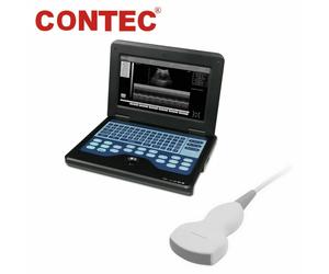 CE Nuova macchina portatile portatile ecografo digitale sonda 3.5MHz Convex