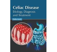 Celiac Disease: Etiology, Diagnosis and Treatment