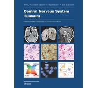 Central Nervous System Tumours - World Health Organization -