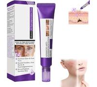 Ceoerty Epiglow MelanEX Advanced Anti-Hyperpigmentation Cream, Epiglow Melanex Cream, Hyperpigmentation Treatment, Dark Spot Remover for All Type Skin (1 Pcs, 20g)
