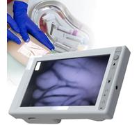 Cercatore di vene portatile, display LCD con regolazione della luminosità a infrarossi, for infermieri, medici, anziani e bambini