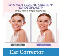 Cerotti per orecchie invisibili, per uso estetico quotidiano, cerotti per orecchie per donne e uomini Polipropilene