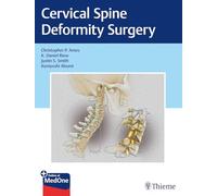 Cervical Spine Deformity Surgery