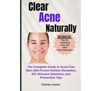 Charles James Clear Acne Naturally (Tascabile)