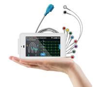 CheckMe ECG professionale a 12 derivazioni, ECG digitale con algoritmo di Glasgow, acquisizione e analisi dei dati ECG in tempo reale, trasferimento dati WIFI e stampa dei report