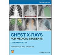 Chest X-Rays for Medical Students: CXRs Made Easy