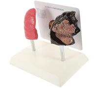 CHICAMPERA Modello di Polmone Anatomico in Pvc per Insegnamento della Fisiologia e Anatomia, Realistico e Didattico, per Studenti e Lezioni Scolastiche