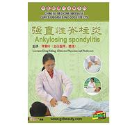 CHINESE MEDICINE MASSAGE CURES DISEASES IN GOOD EFFECTS--Ankylosing spondylitis
