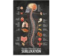 Chiropractic Adjustment Zones Poster Canvas Print Clinic Decor