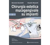 Chirurgia estetica mucogengivale su impianti