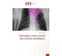 Chirurgie a c¿ur ouvert des masses cardiaques