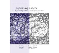Christine M Lovly Lung Cancer: Disease Biology and Its Poten (Copertina rigida)