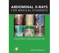 Christopher Clarke Anthony Dux Abdominal X-rays for Medical Students (Tascabile)