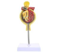 Ciieeo Modello Anatomico Glomerulo Renale con Base Didattico per Insegnamento Struttura Resistente e Facile da Esibire