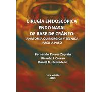 CIRUGÍA ENDOSCÓPICA ENDONASAL DE BASE DE CRÁNEO: ANATOMÍA QUIRÚRGICA Y TÉCNICA PASO A PASO