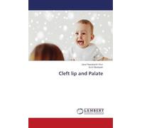 Cleft lip and Palate
